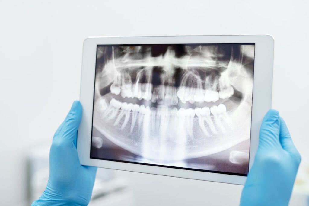pexels-photo-4270367 Blue-gloved hands holding a digital tablet displaying a detailed dental X-ray scan.